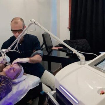 Corrección de manchas en la cara con Laser CO2