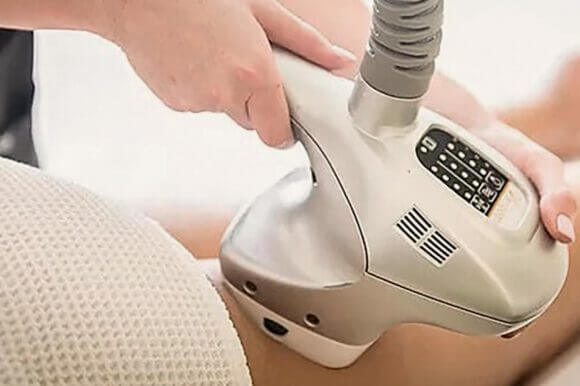 velashape-tecnologia-adiposidad-celulitis Tecnología Veashape para la reducción de grasa localizada, celulitis y adiposidad.