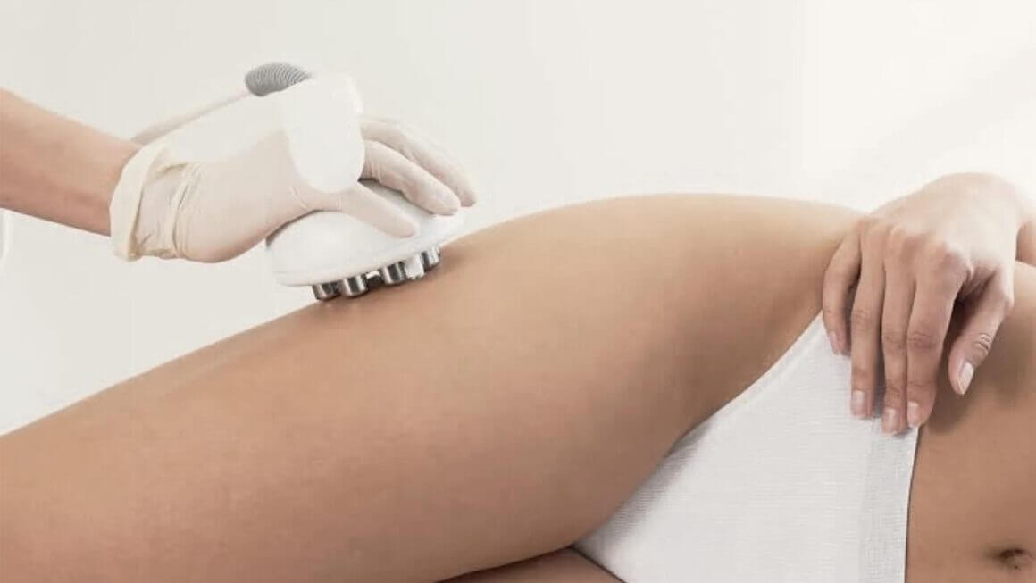 venus-legacy-adiposidad-celulitis Tecnología Venus Legacy para la reducción de grasa localizada, celulitis y adiposidad.