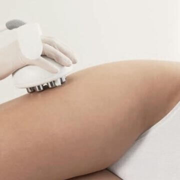 Tecnología Venus Legacy para la reducción de grasa localizada, celulitis y adiposidad.