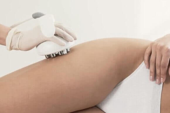 venus-legacy-adiposidad-celulitis Tecnología Venus Legacy para la reducción de grasa localizada, celulitis y adiposidad.