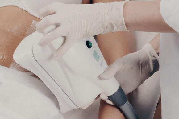 cooltech-reduccion-de-adiposidad-abdomen El nuevo y revolucionario sistema para la reducción de grasa y adiposidad localizada.